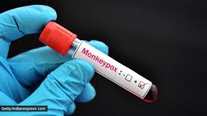 Pakistan authorities detect three mpox cases linked to UAE travel
